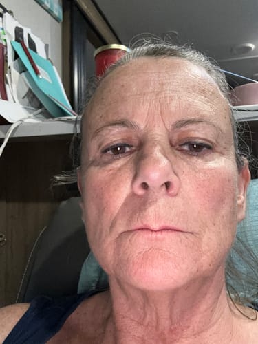 Customer photo review of Glov Micro Infusion System