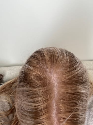 Customer photo review of Sunkissed Starter Kit