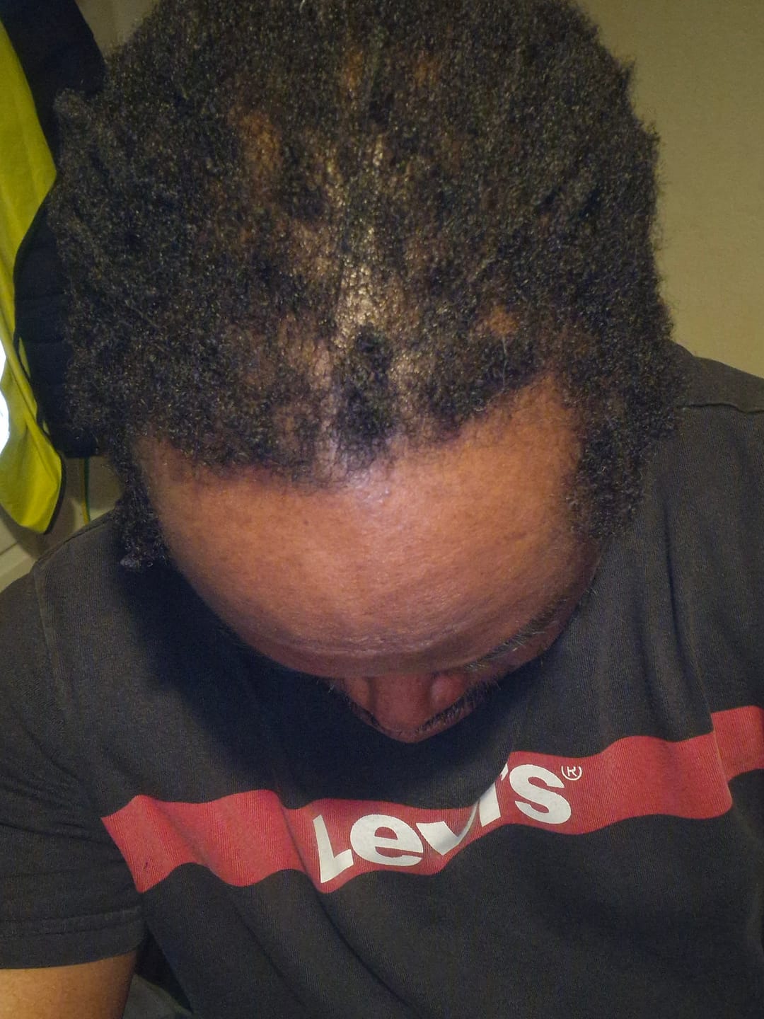Customer photo review of Batana Oil for Hair