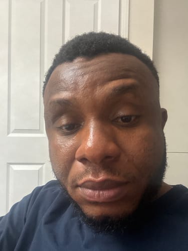 Customer photo review of Turmeric Glow Soap