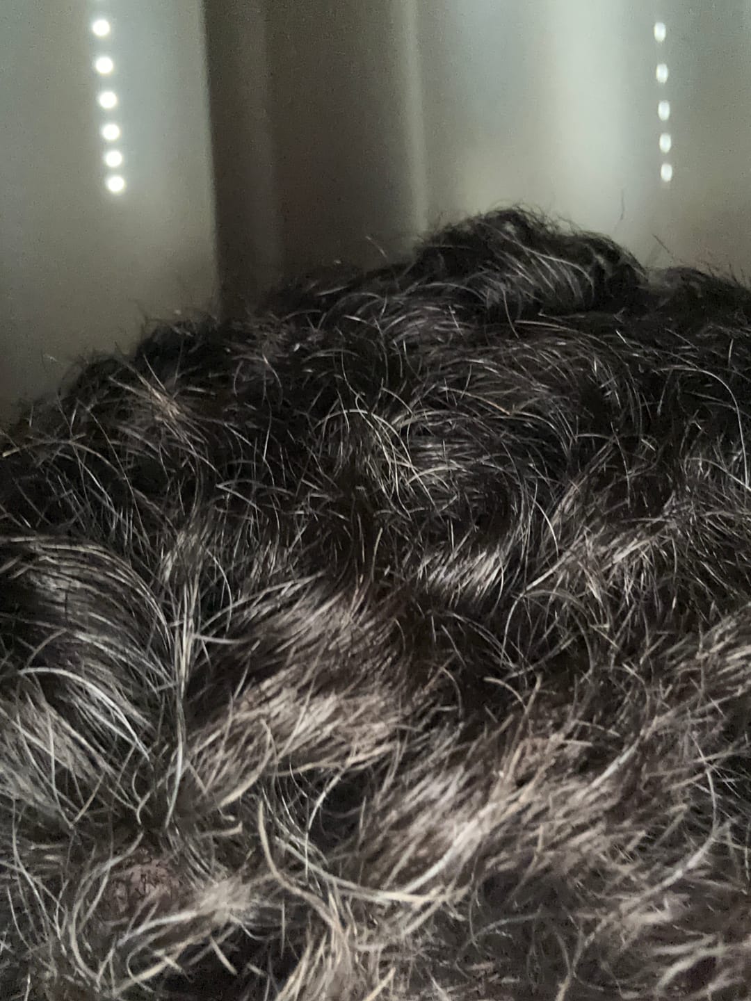 Customer photo review of Psoriasis Honey Renewing Shampoo