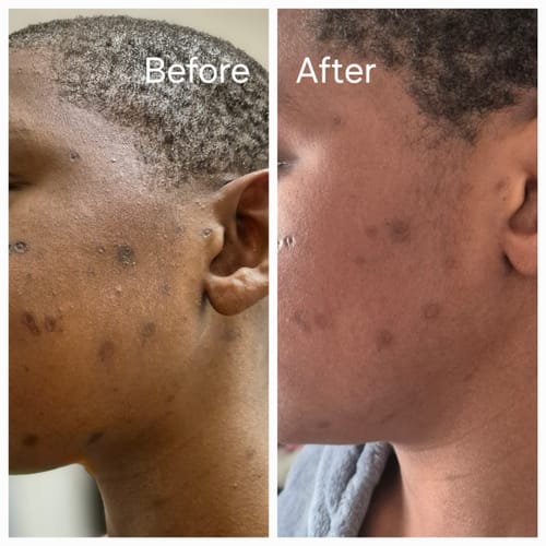 Customer photo review of Turmeric Glow Soap