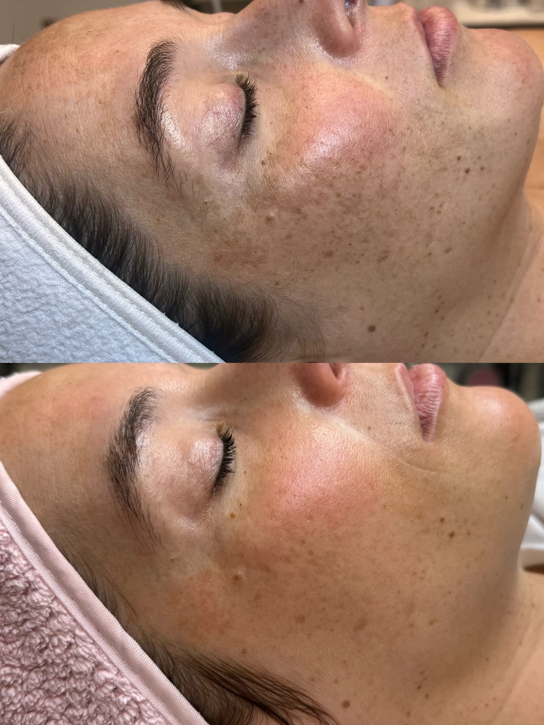 Customer photo review of Zena 100% Organic Algae Peel
