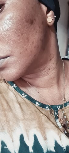 Customer photo review of Turmeric Glow Soap