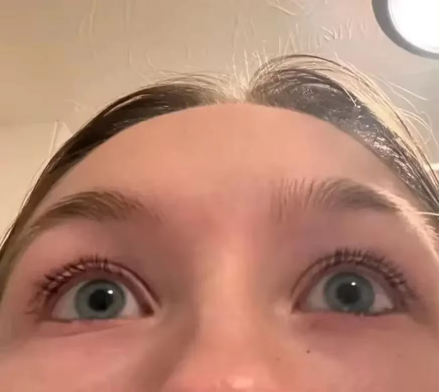 Customer photo review of LashGrow™ Serum