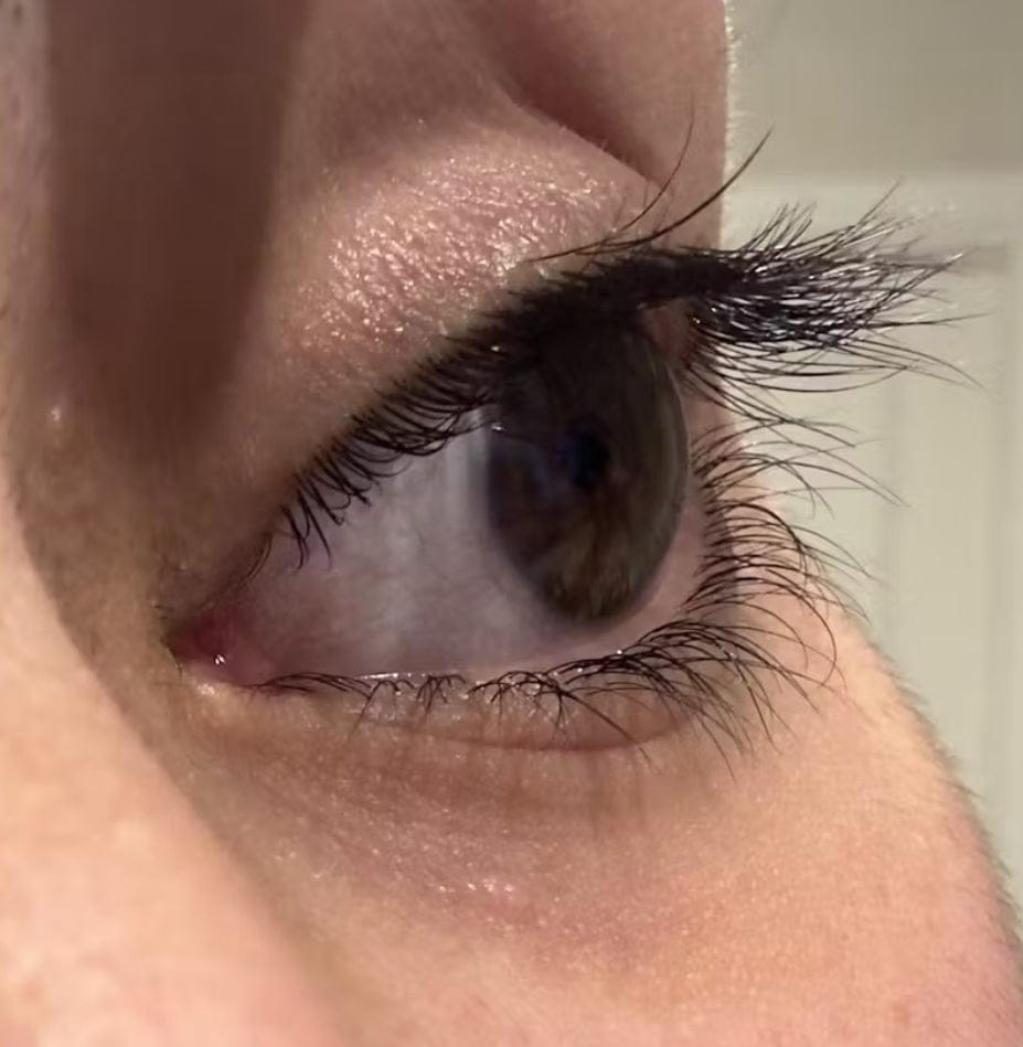 Customer photo review of Eyelash Growth Serum