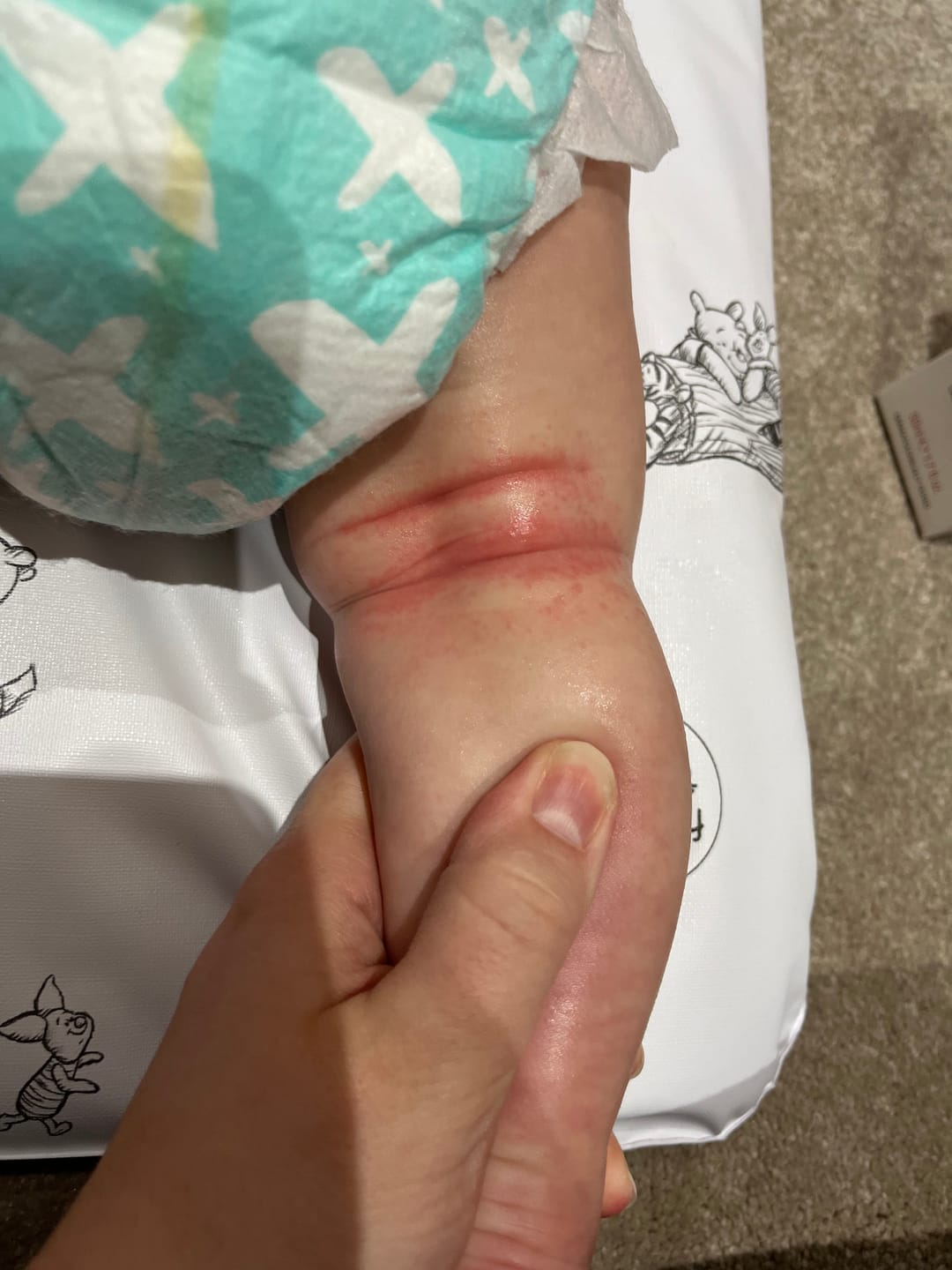 Customer photo review of Bioskin Junior Duo Pack
