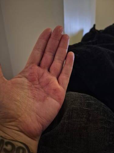 Customer photo review of MYLASMOSS SEAMOSS GEL (340ML)