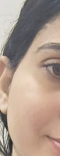 Mahnoor Z. review of Melasma Bundle - 24 Hours Protection image 1 out of 2