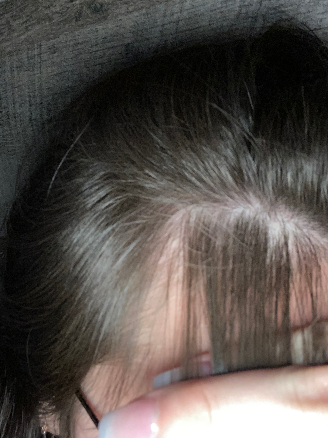 Real Growplex customer scalp