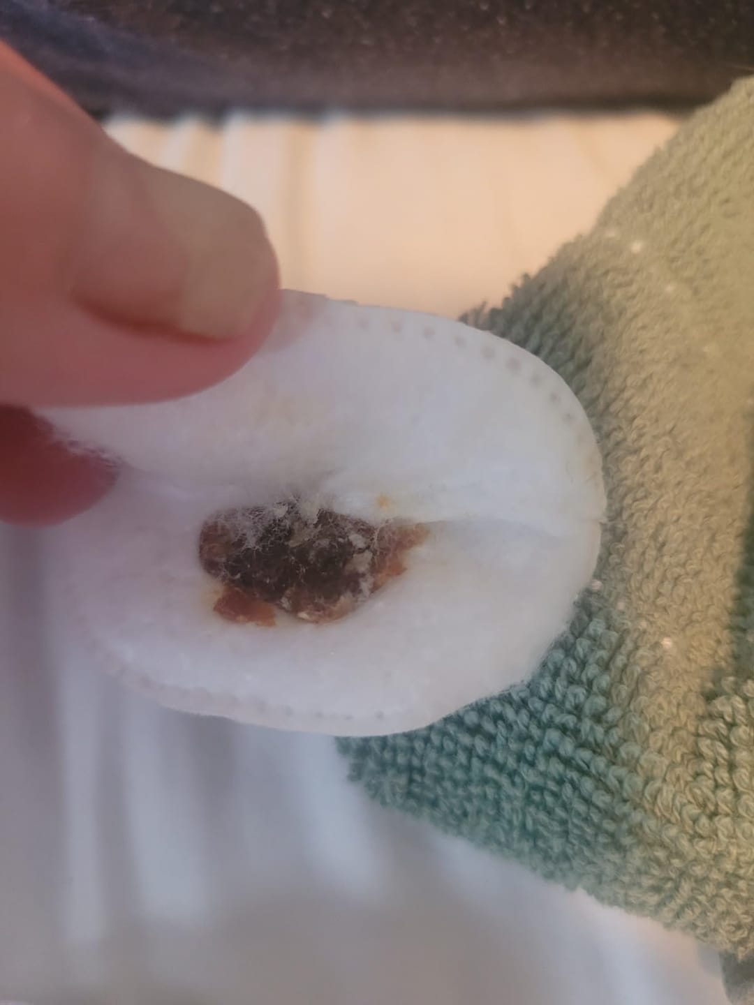 Customer photo review of ClearEar™ Earwax Removal Tool