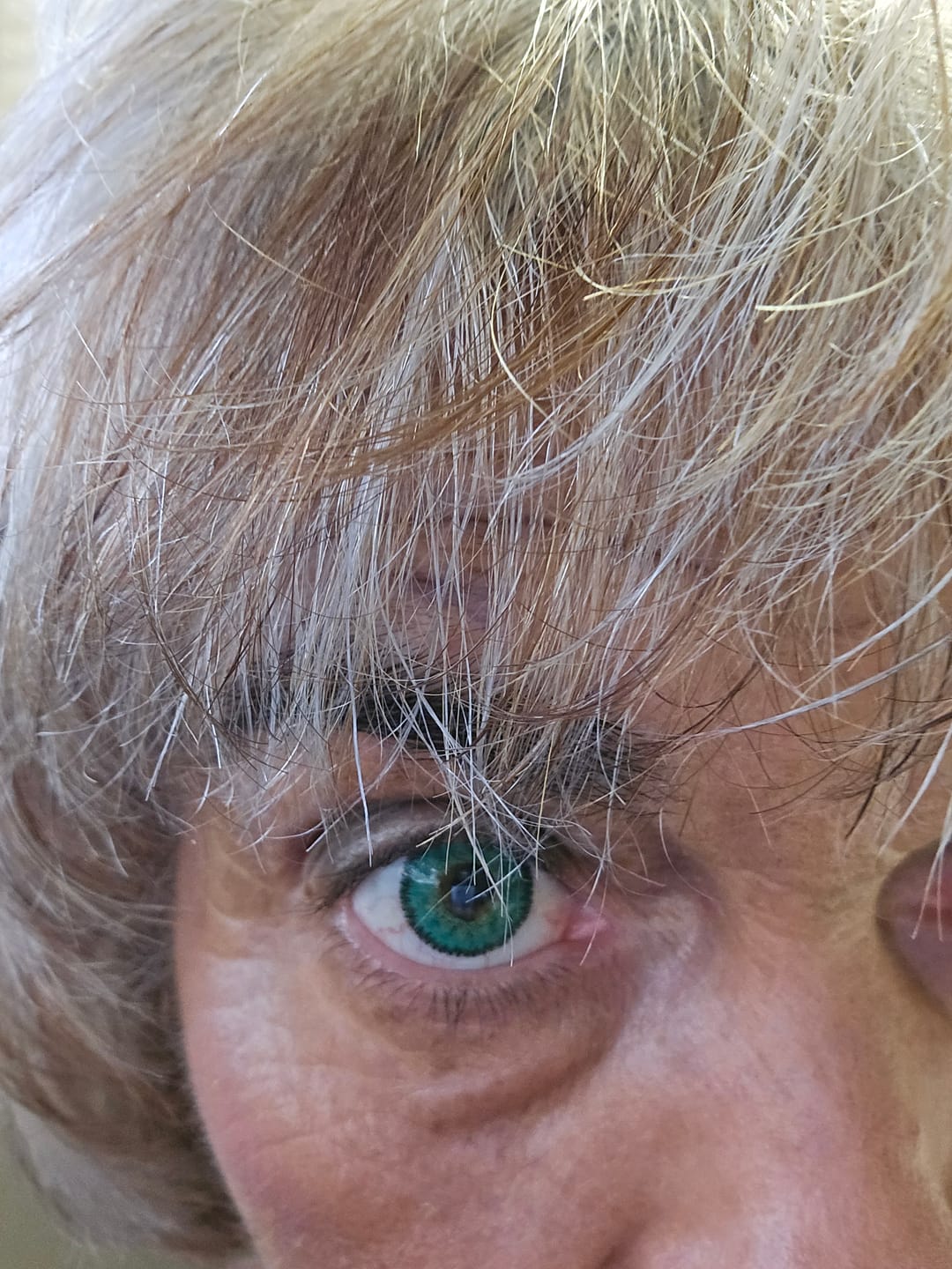 Customer photo review of Perla Blue Prescription Colored Contact Lenses