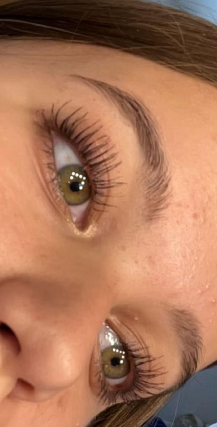 Customer photo review of Eyelash Growth Serum