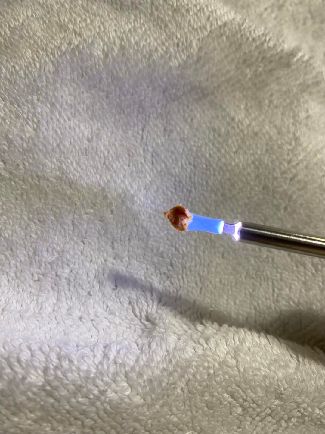 Customer photo review of ClearEar™ Earwax Removal Tool