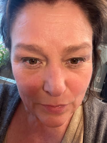 Customer photo review of Firming Rejuvenation Facial Serum