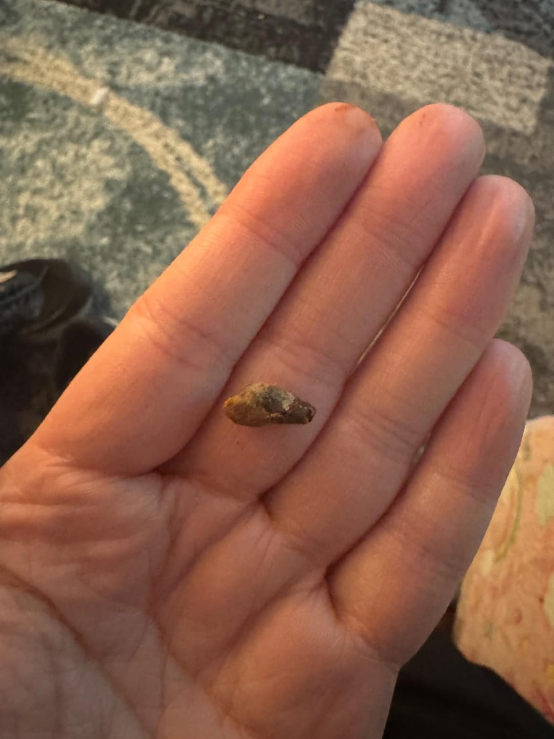 Customer photo review of ClearEar™ Earwax Removal Tool