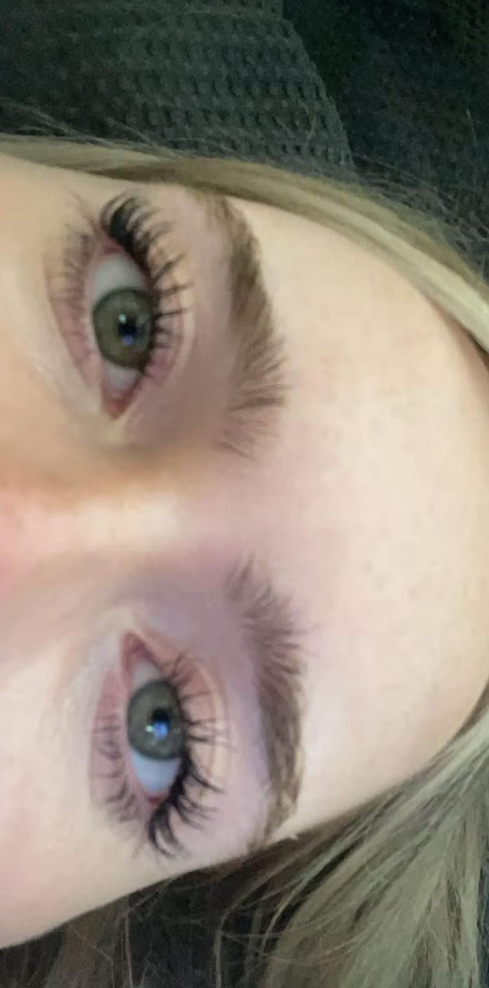 Customer photo review of Eyelash Growth Serum