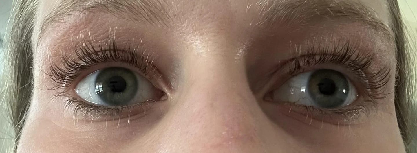 Customer photo review of LashGrow™ Serum
