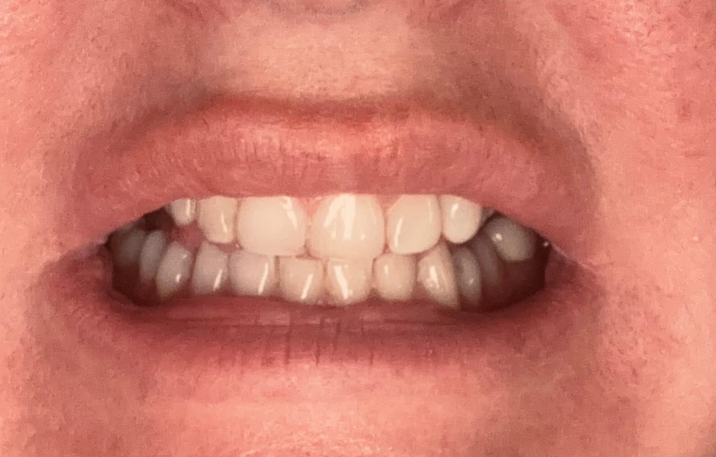 Customer photo review of Oral Care Essentials Bundle