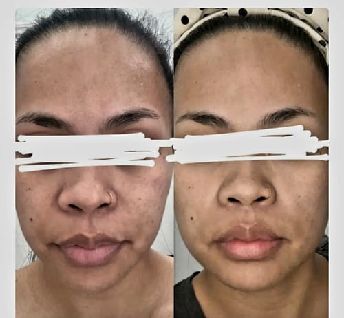 Customer photo review of Turmeric Glow Soap