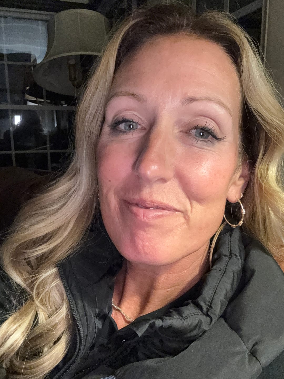 Customer photo review of Anti-Aging treatment