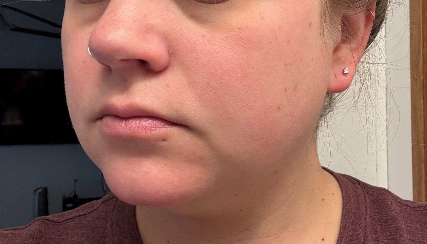 Customer photo review of Restore and RENEW Firming & Anti-Aging Balm