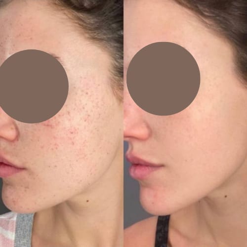 Customer photo review of Tisane Glow up ®