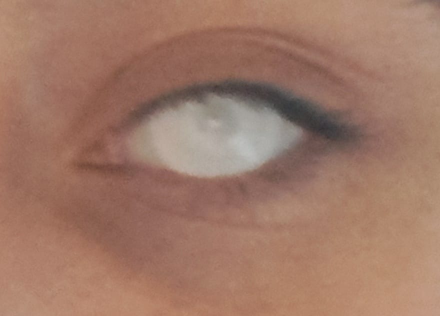 Customer photo review of Zombie White Screen Halloween Lens