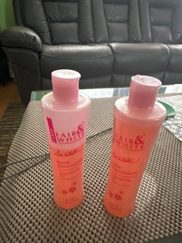 Customer photo review of Fair & White So White Stubborn Spots and Body