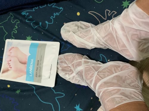 Customer photo review of Lanbena Exfoliating Foot Peel Mask