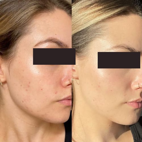 Customer photo review of Tisane Glow up ®