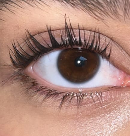 Customer photo review of Lanbena Eyelash Growth Serum