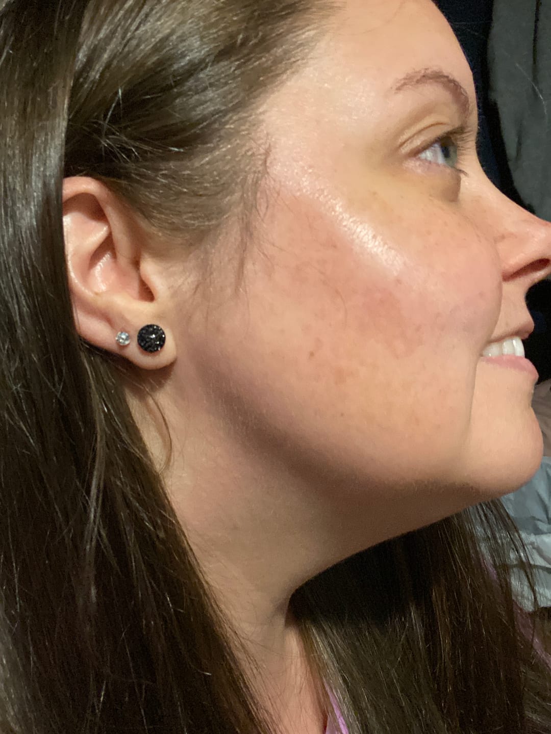 Customer photo review of Petite Faux Diamond Studs Hypoallergenic Earrings for Sensitive Ears Made with Plastic Posts