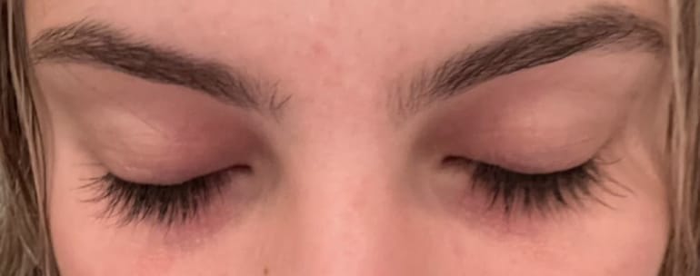 Customer photo review of Lanbena Eyelash Growth Serum