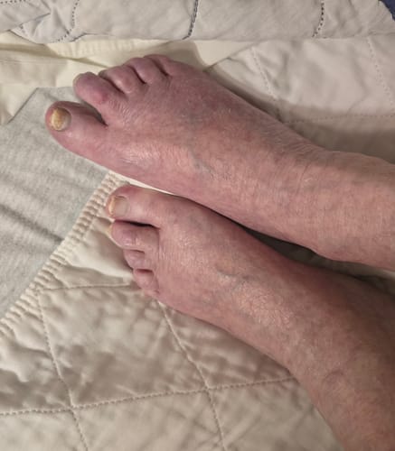 Customer photo review of Mama Bear Nerve Relief Lotion