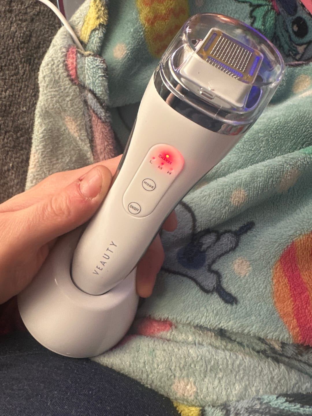 Customer photo review of Veauty Dot
