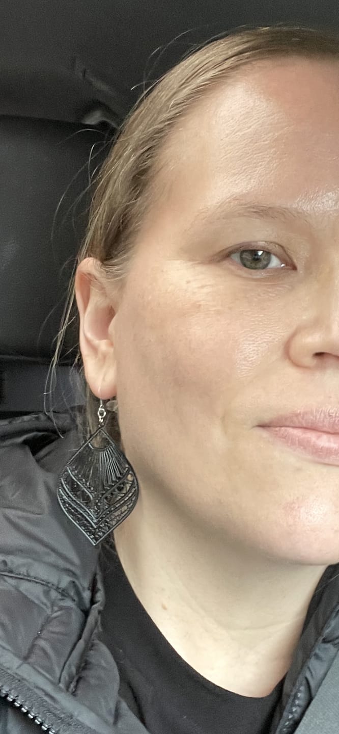 Customer photo review of Large Peacock Dangles Hypoallergenic Earrings for Sensitive Ears Made with Plastic Posts