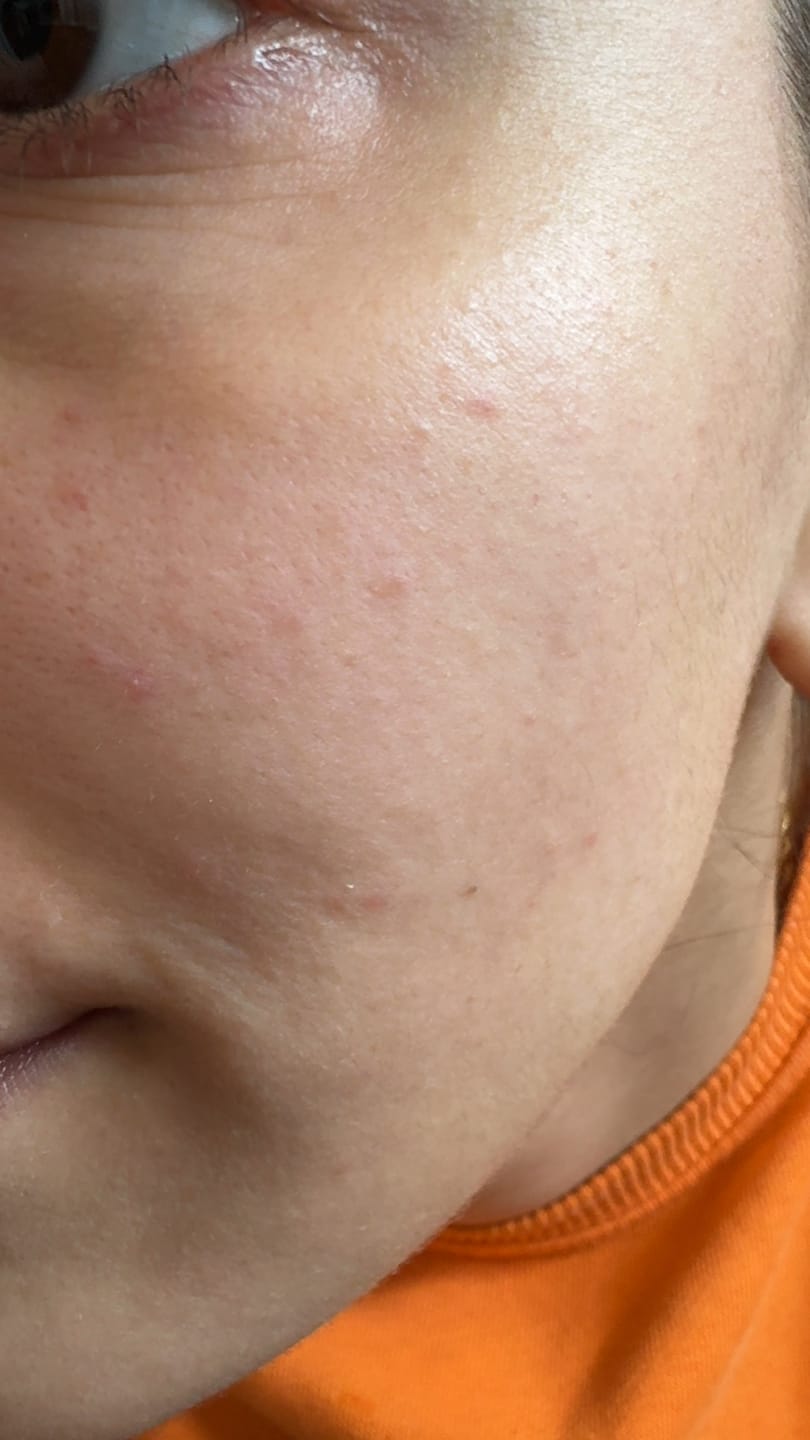 Customer photo review of 5er Pack GLOWYSIDEUP® Overnight Leave-On Maske