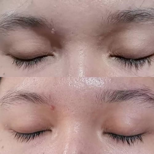 Customer photo review of Lanbena Eyelash Growth Serum