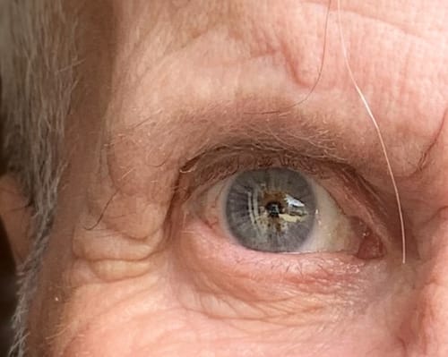 Customer photo review of Hand Painted Blue Silver Eye Ring