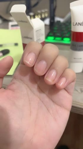 Customer photo review of Lanbena Nail Repair Essence Serum