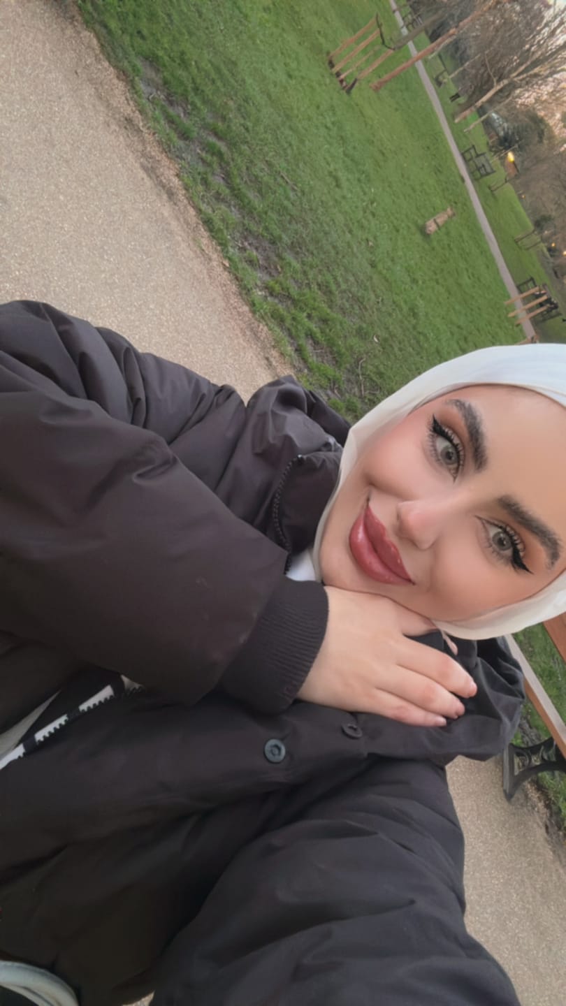 Customer photo review of Gray Olive Contact Lenses