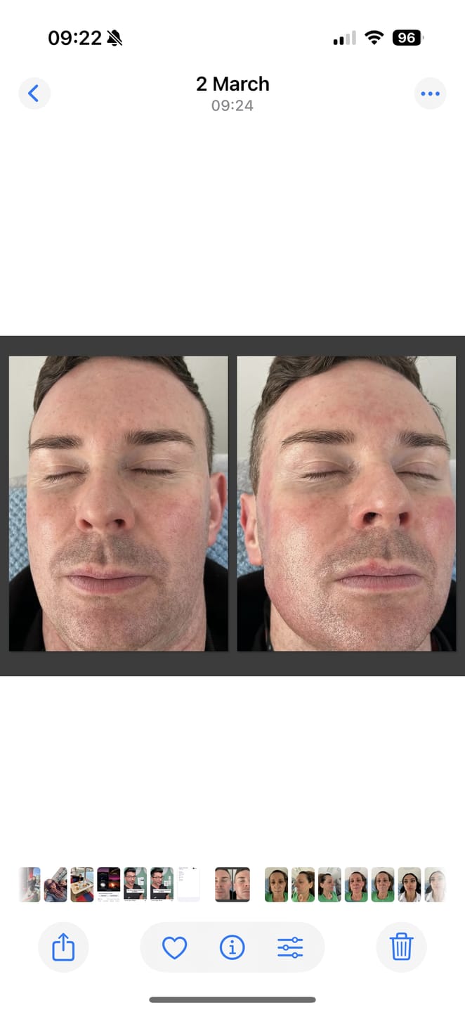 Customer photo review of Anti-Aging treatment