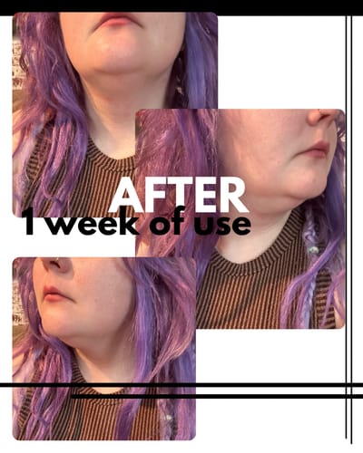 Customer photo review of Liftlab Face Sculpting Tool + Free Serum