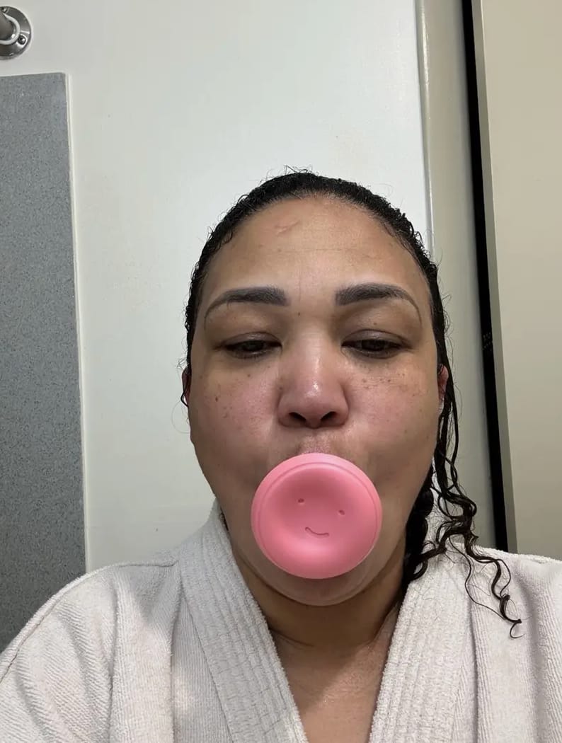 Customer photo review of Saludea Youth Lift