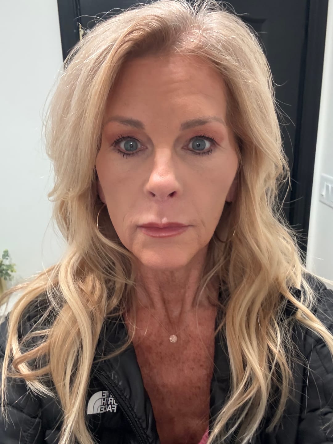 Customer photo review of Glow Peel Pads