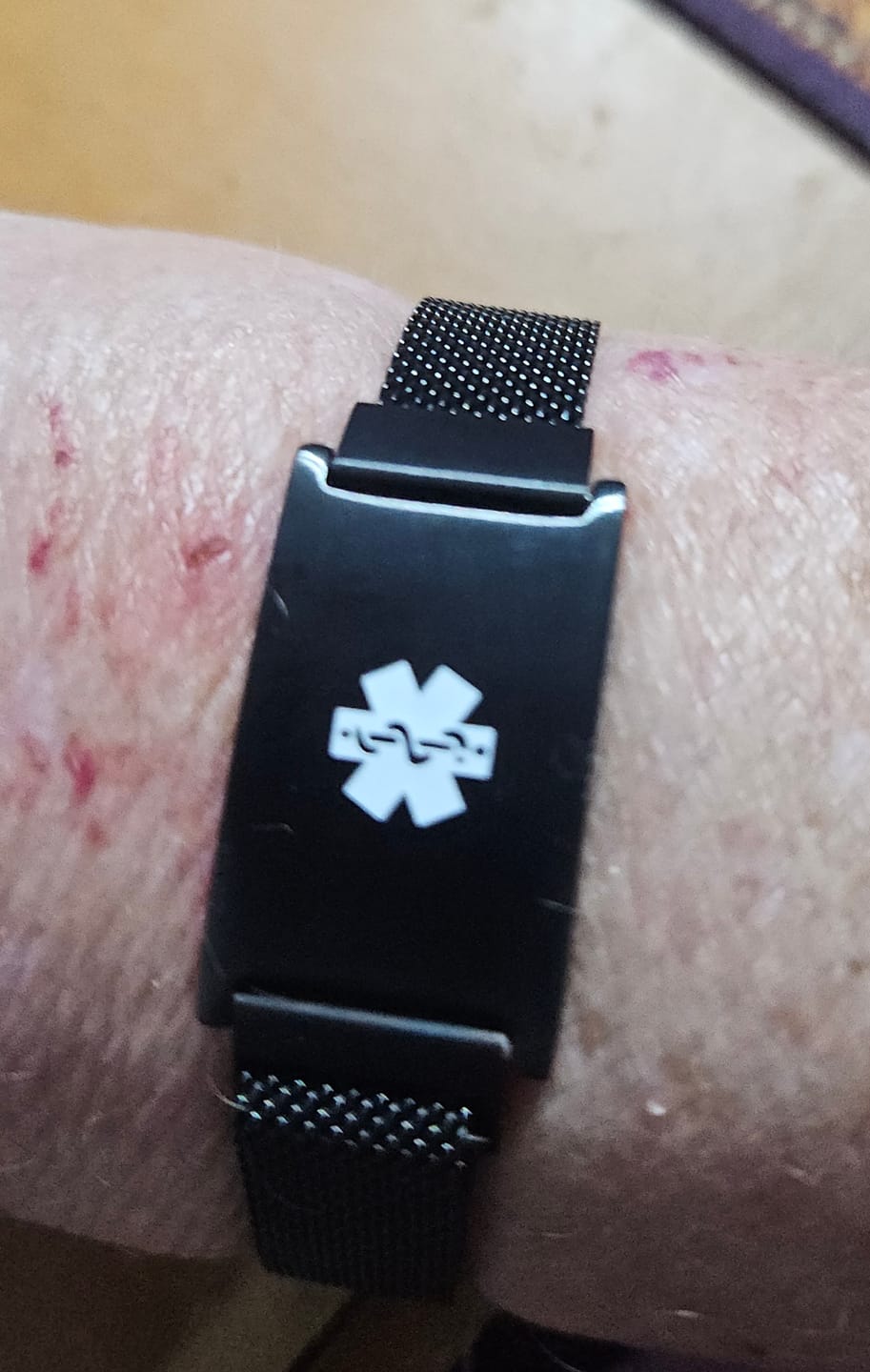 Customer photo review of Roxie Medical Alert Bracelet with Magnetic Closure – Black