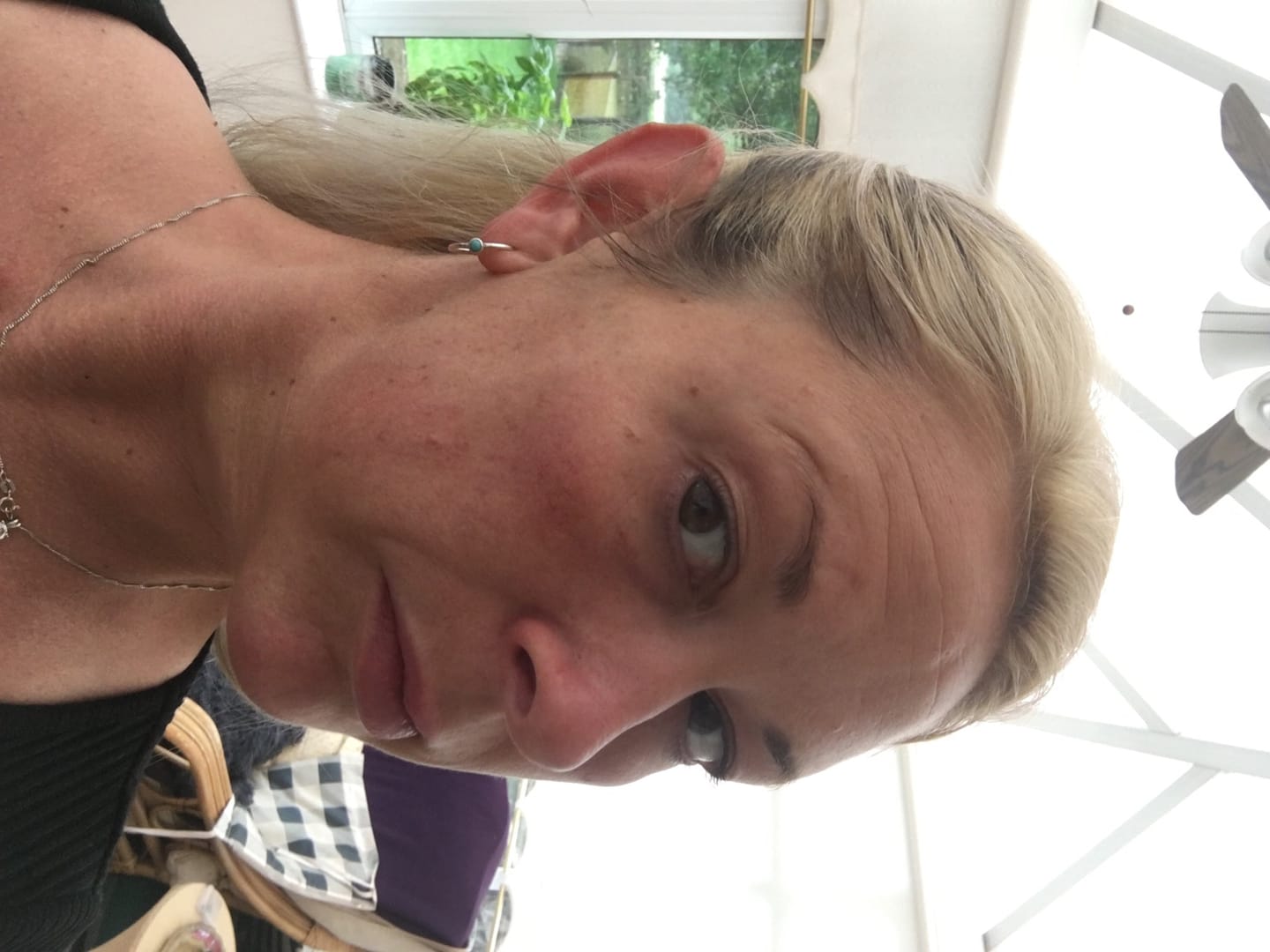 Customer photo review of Vegan Collagen - Vollagen®