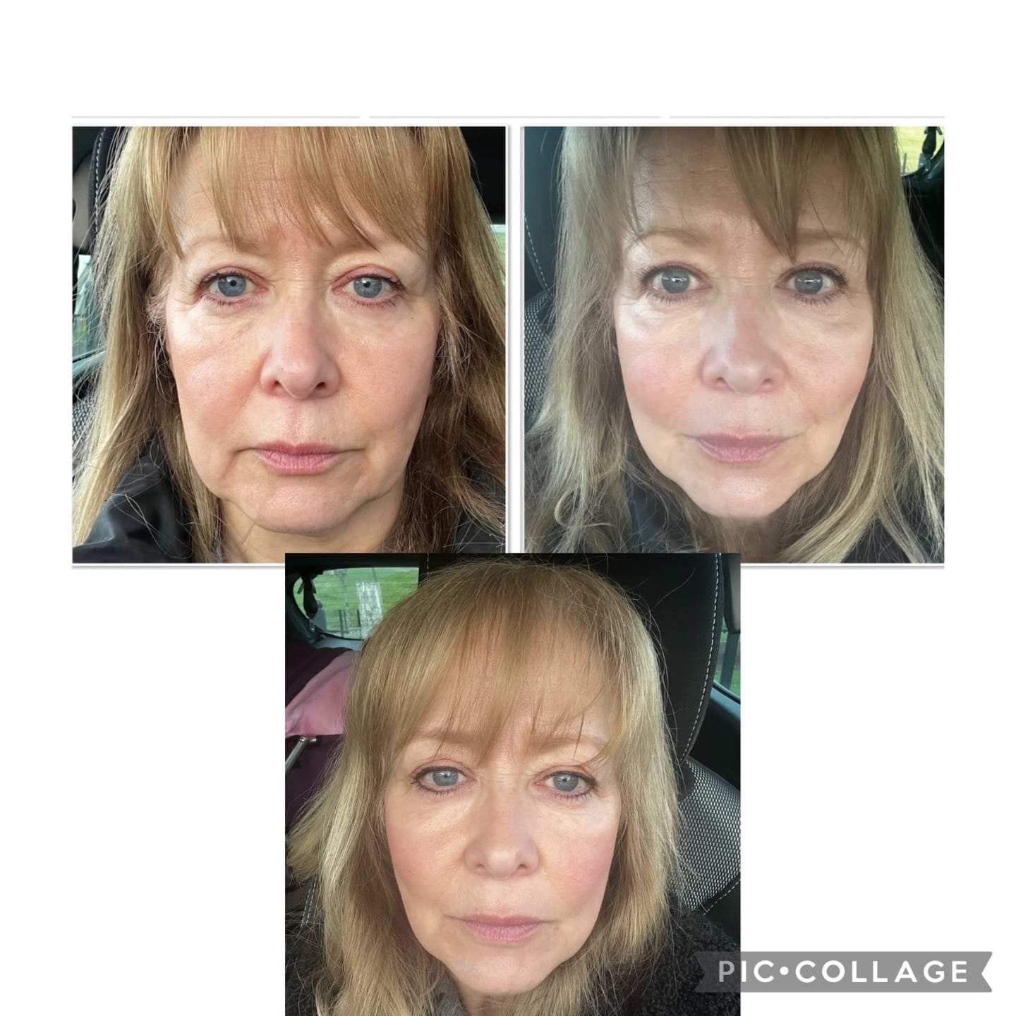 Customer photo review of Vegan Collagen - Vollagen®