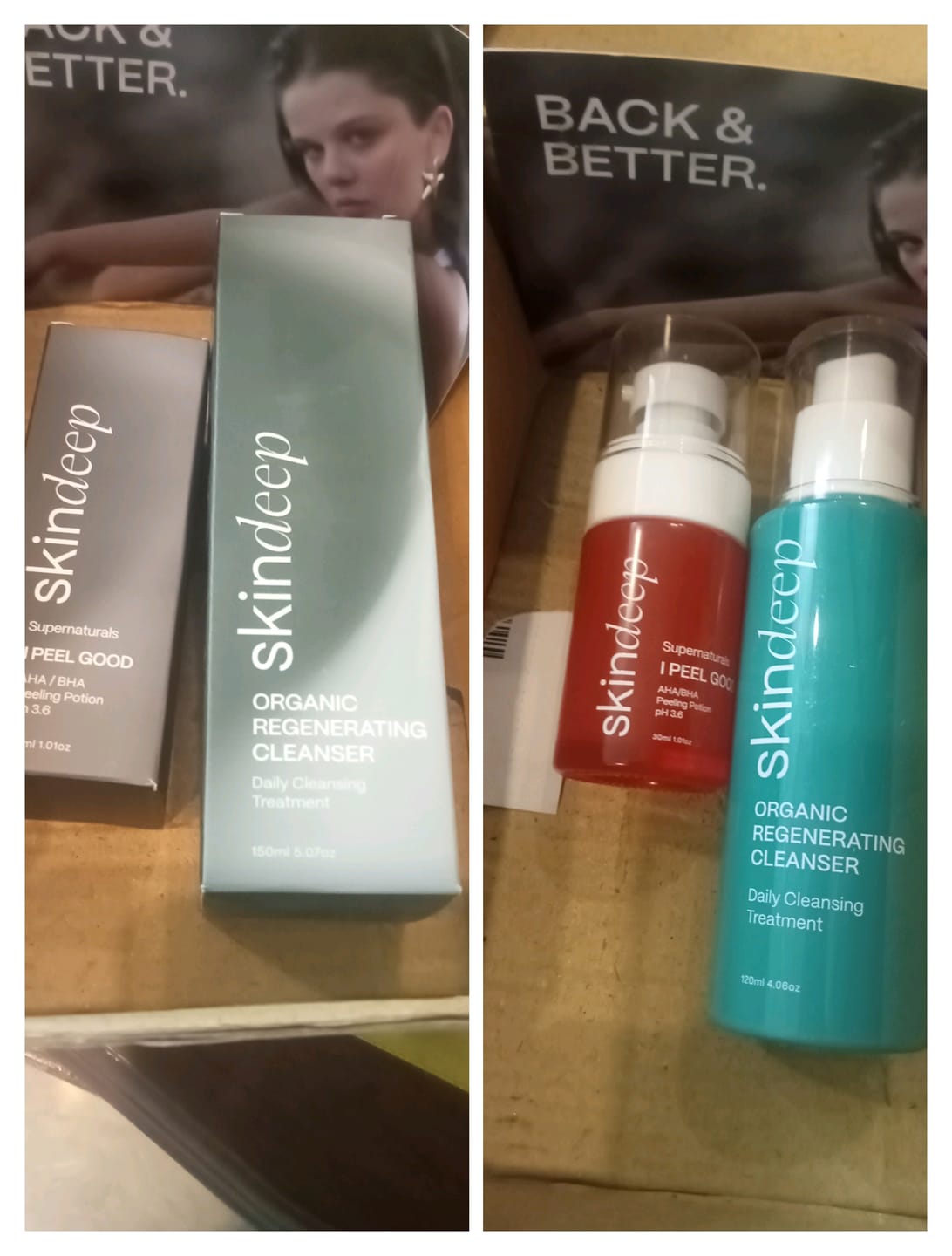 Customer photo review of I PEEL GOOD - AHA/BHA Peeling Potion